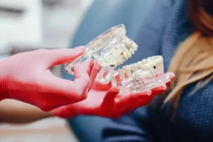Dentures for full or partial tooth replacement