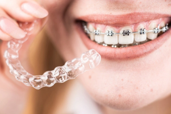 Teeth Straightening