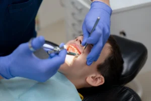 Dental Caps for damaged teeth