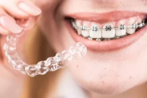 Smile Designing & Cosmetic Dentistry